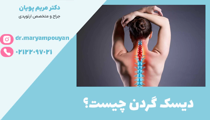 دیسک گردن چیست؟