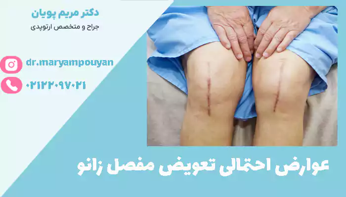 عوارض تعویض مفصل