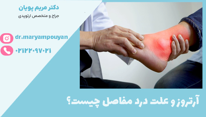 آرتروز و علت درد مفاصل چیست؟