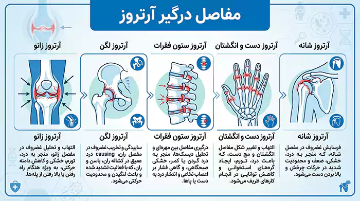اینفوگرافیک آرتروز مفاصل